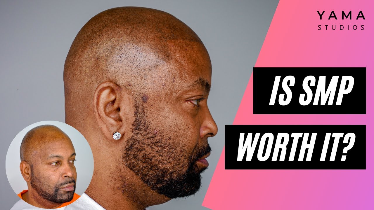 YAMA Studios Hawaii Scalp Micropigmentation Review