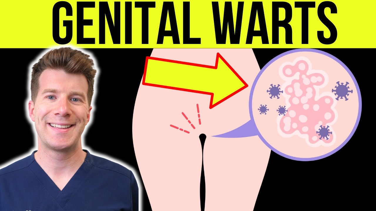 Genital Warts: Causes, Symptoms & Treatment 💊