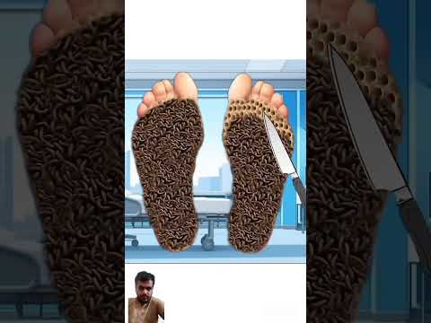 Pairon Mein kide Lage #animation #cartoon #funny #amazingfacts