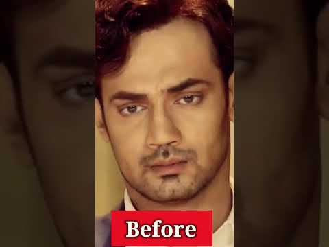 Zahid Ahmed SURGERY Transformation Short l P Montage l