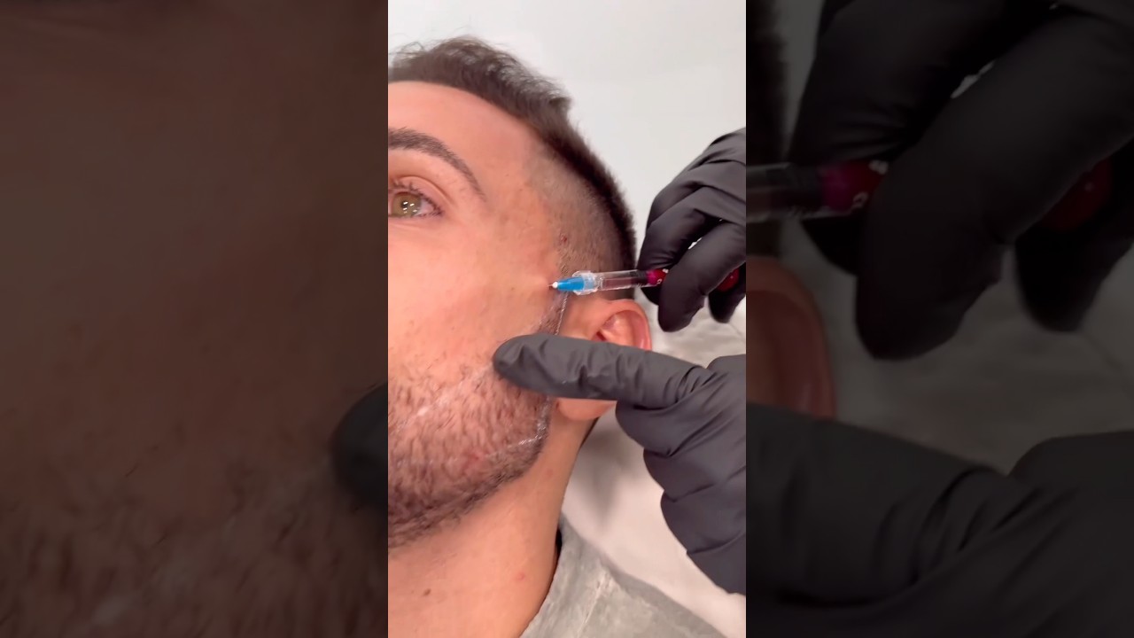 Ultimate Natural Mewing Tutorial for a More Defined Jawline ✨