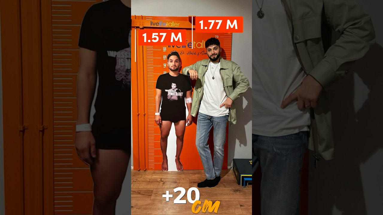 Sedat, the Limb Lengthening King, Gains Global Fame 🌍