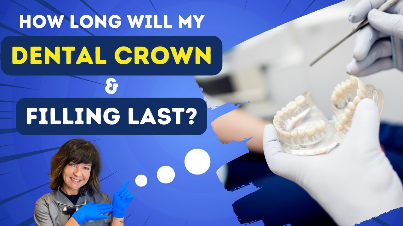 Dental Crown & Filling Longevity 🦷