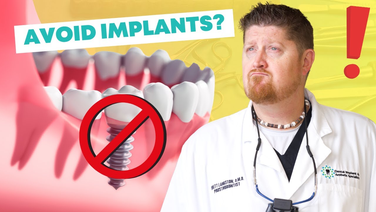 Why You Might Want to Skip Dental Implants 🚫