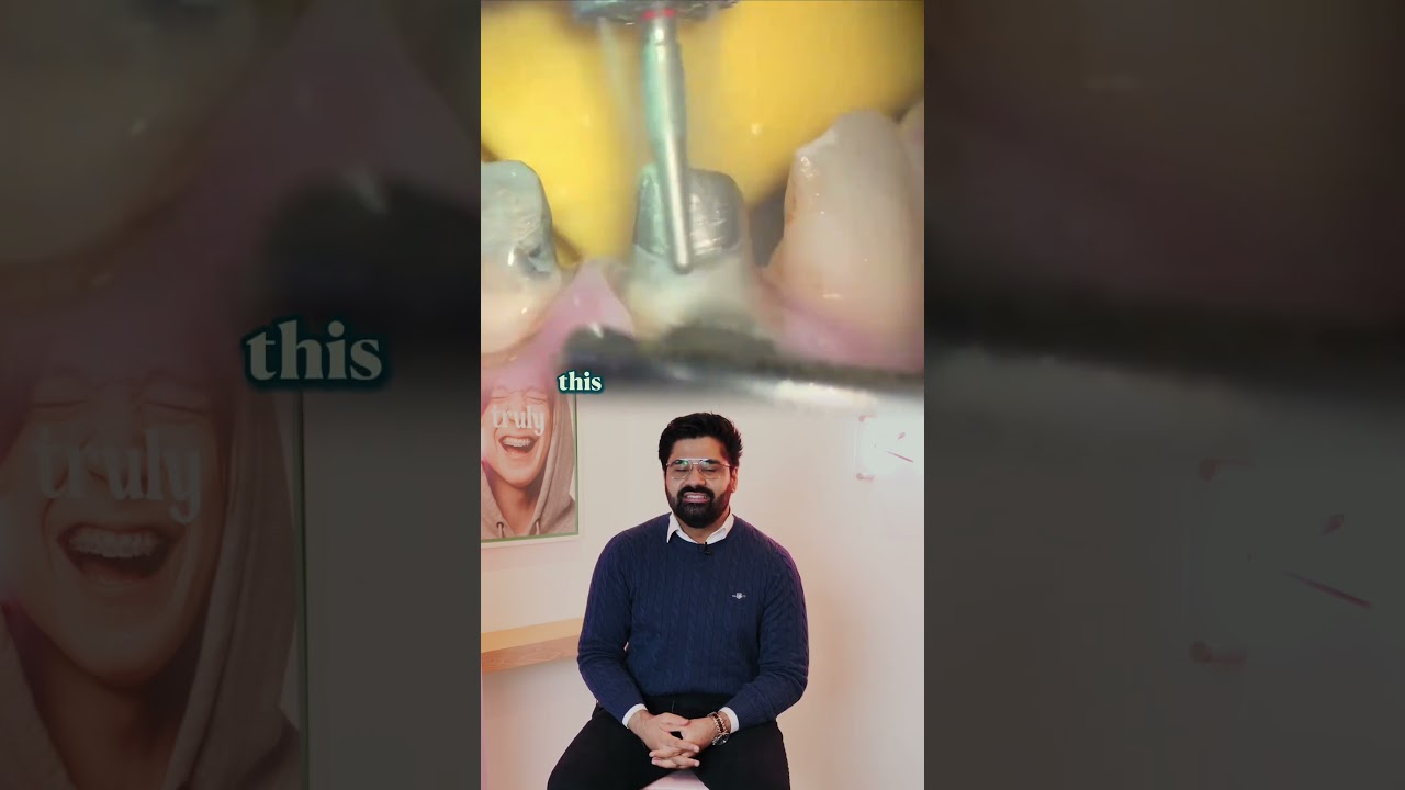 Risks of Dental Crowns 🦷👑 #trulydental #dentist #qanda #crowns #risks #teeth