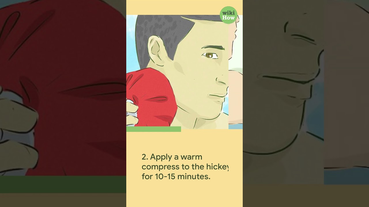 Quick & Easy Ways to Remove a Hickey Fast 🚀