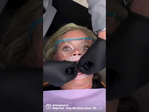 How Veneers are Placed #shorts #veneers #patienteducation