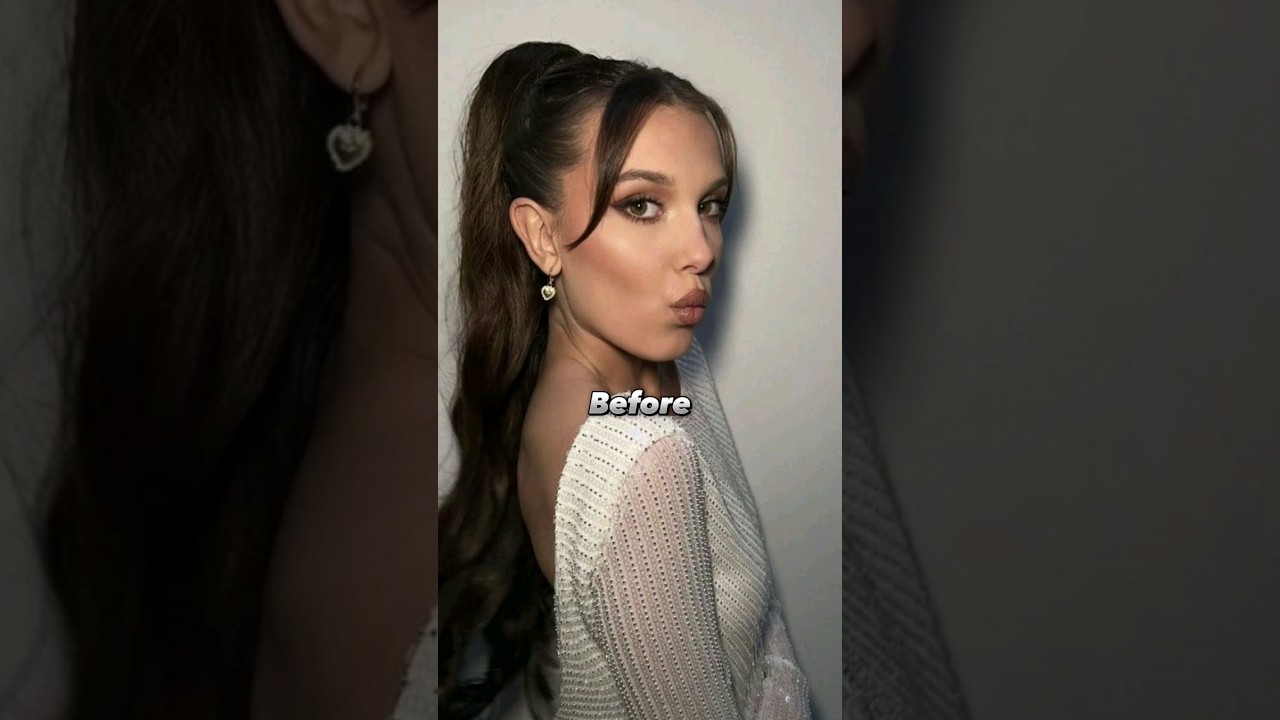 Millie Bobby Brown's Stunning Transformation: Before & After Plastic Surgery ✨