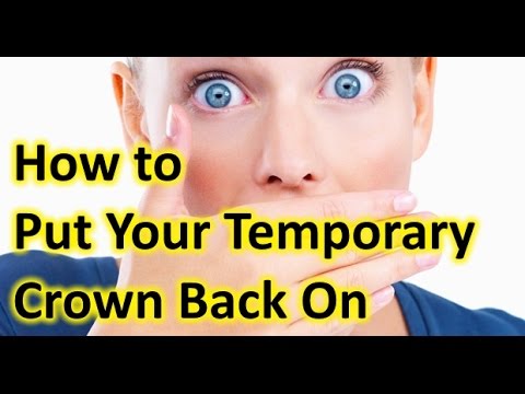 What to Do if Your Temporary Crown Falls Off 🦷