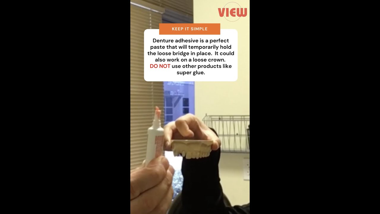 Fix Loose Bridge Temporarily with Denture Adhesive 🦷