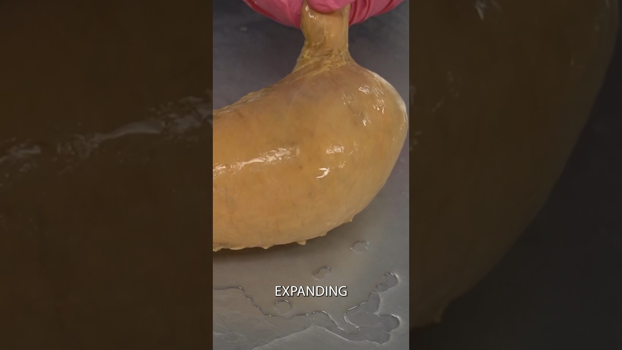 Size of the Human Stomach 🧠