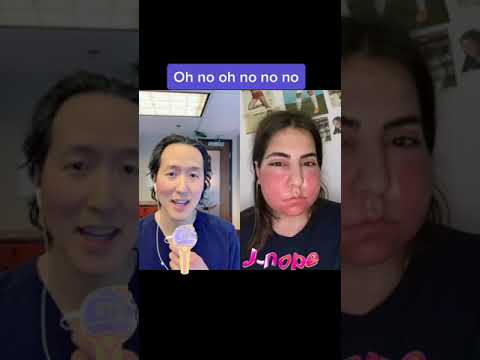 Massive Allergic Reaction?!?! #shorts #allergicreaction