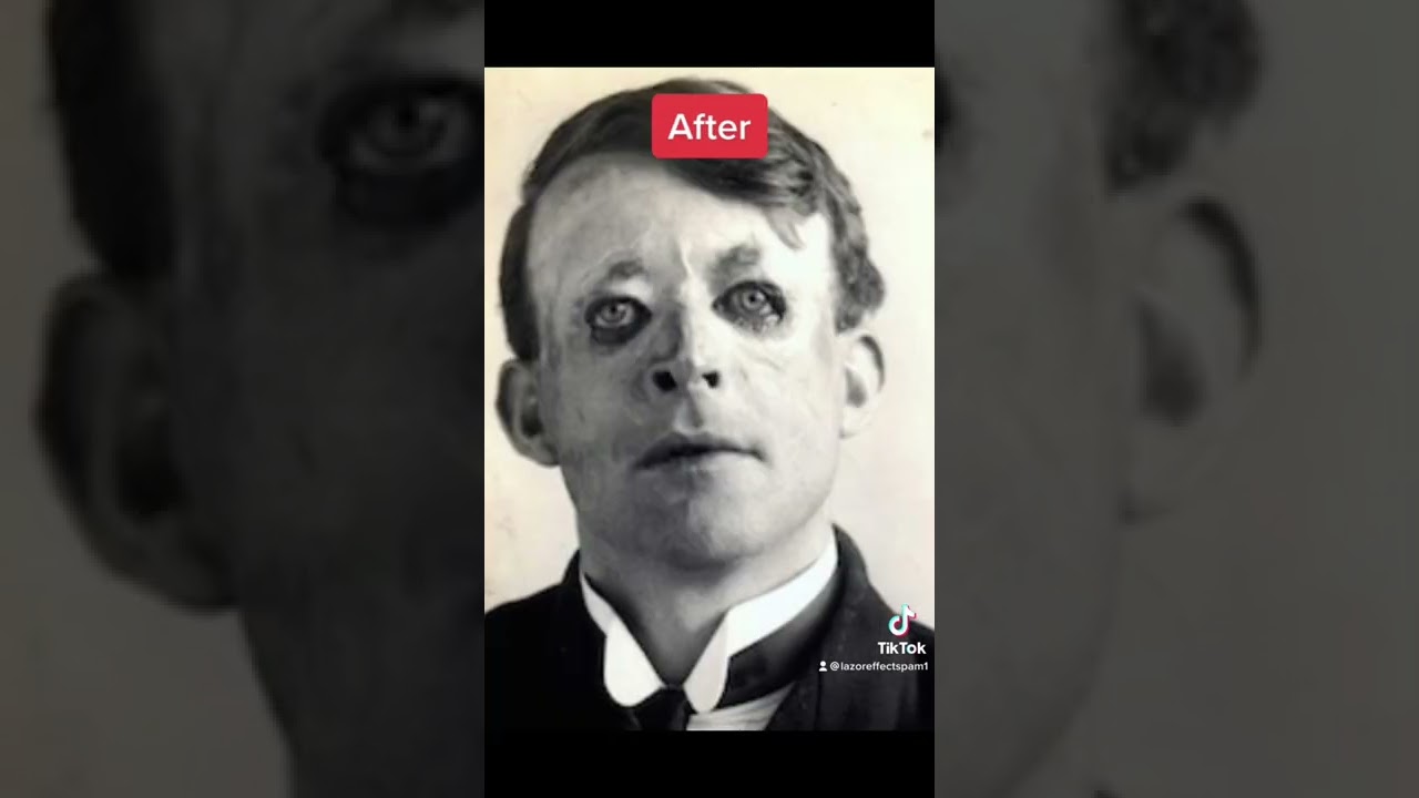 Soldiers Before & After WW ๐ช #shorts