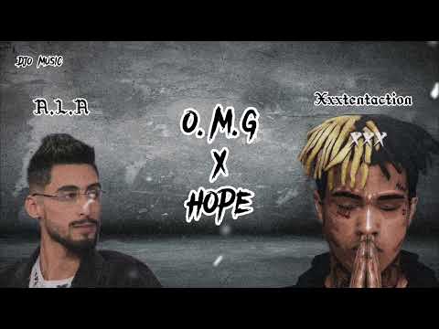 A.L.A ft Xxxtentacion (O.M.G & Hope)