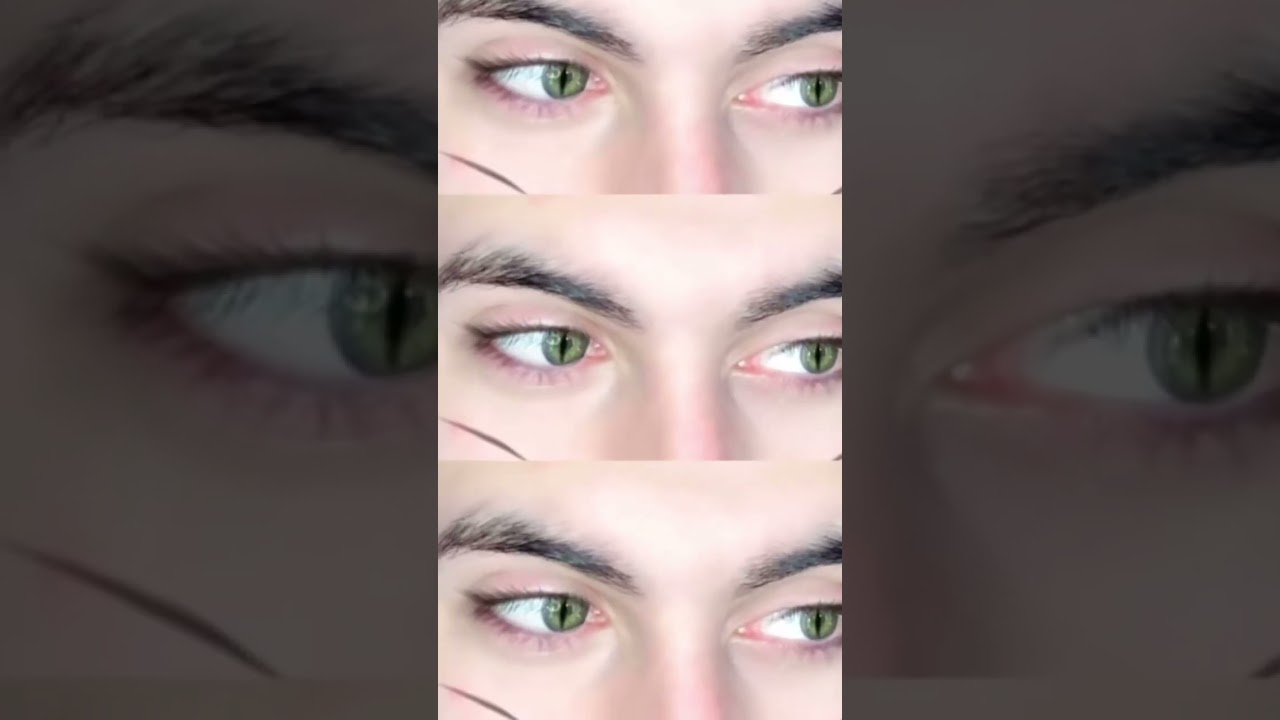 Kedi Gözü 😂 Ferhat Çelen #shorts