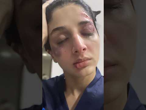 Injured 🩸 Mawra huccain ♥️🥺#share #like #comment