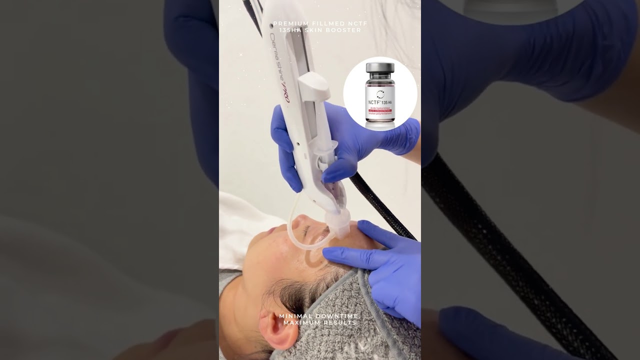 NCTF 135HA Skin Booster at Revive Aesthetic Clinic