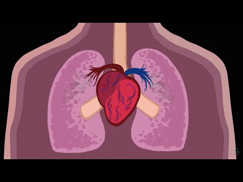 Health Effects of Air Pollution