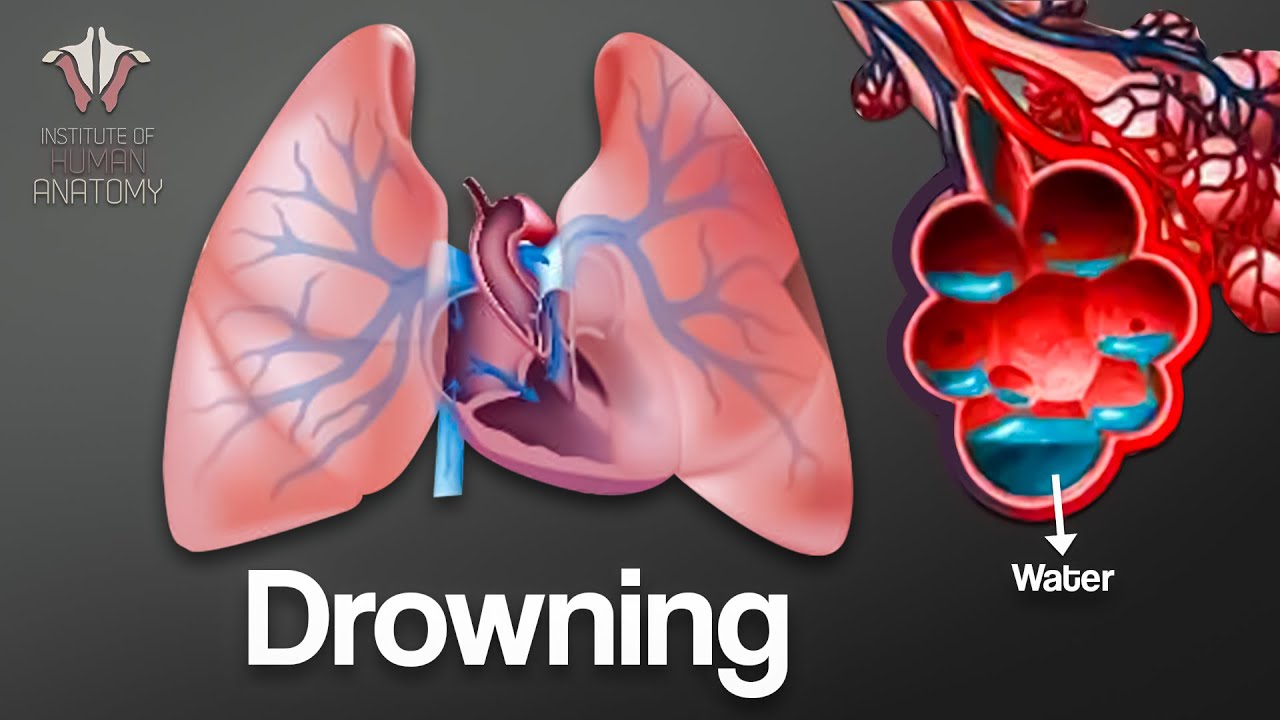 Drowning Explained: A Step-by-Step Breakdown of What Happens 🧠