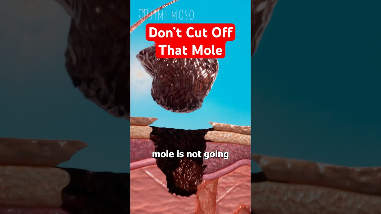 Avoid Cutting Moles at Home 😱