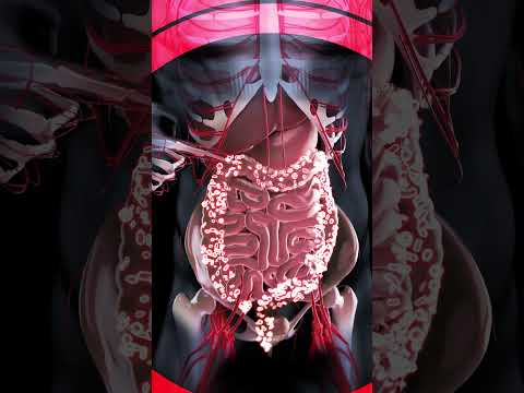 गोंद कतीरा का सेवन कैसे और कब करें – जानिए पूरा तरीका! | Gond Katira | Dr. Bimal Chhajer | SAAOL