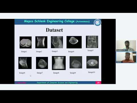 Steganography method to secure patients’ medical report using Wavelet Transform