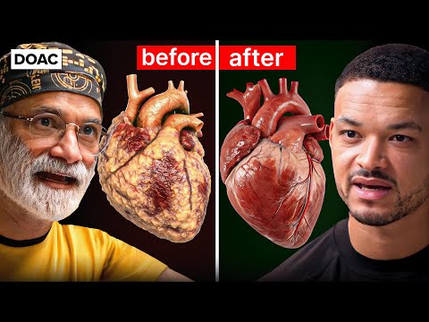 Insulin Doctor: The Fastest Way To Burn Dangerous Visceral Fat! I'm Finding Mould In My Patients!