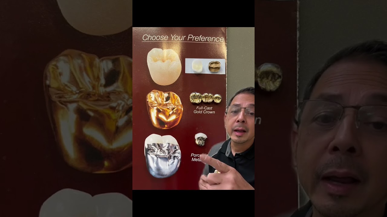 Types of Dental Crowns Explained 🦷