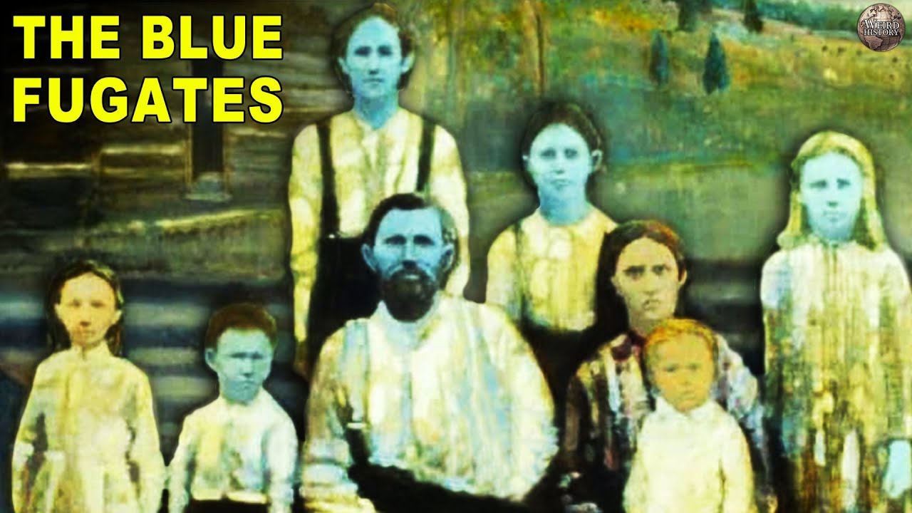The Fascinating Story of the Blue Fugates and Their Rare Blue Skin 🧬