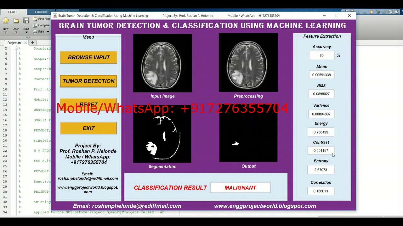 Brain Tumor Detection Using Machine Learning with Source Code in MATLAB