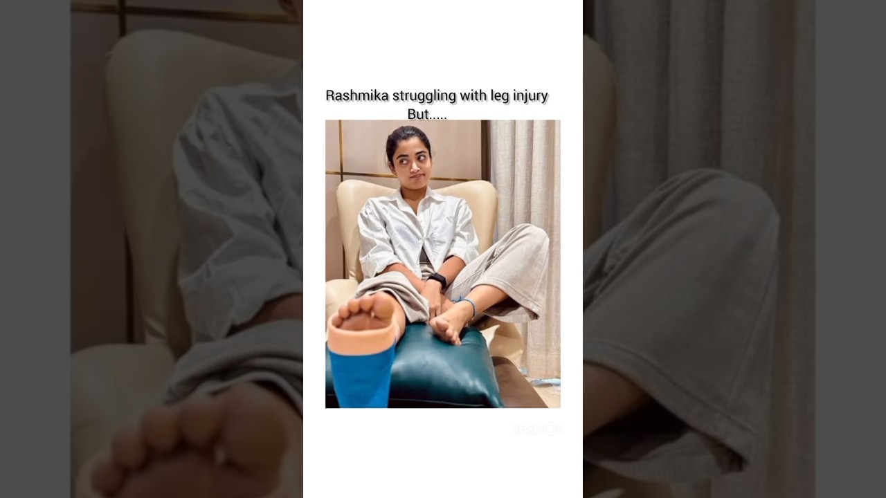 Rashmika Faces Leg Injury Challenge ❤️🔥