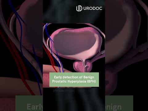 3 Reasons To Check Your Prostate