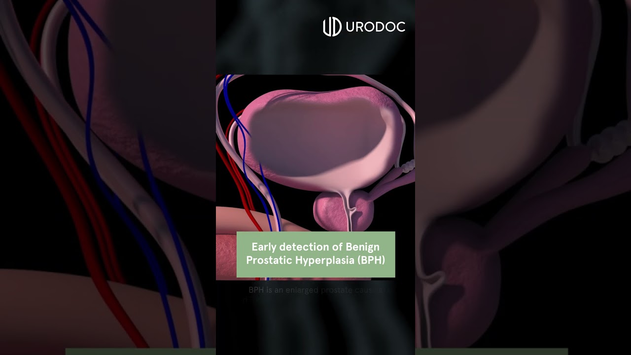 3 Important Reasons to Get Your Prostate Checked 🩺