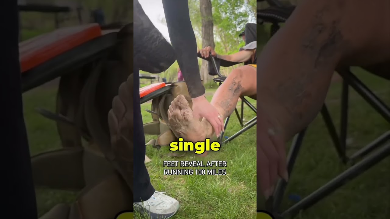 Runner's Feet After 100 Miles 🏃‍♂️