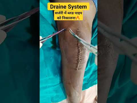 Blood  Draine Sysstem🔥सर्जरी के के बाद जमे हुए ब्लड को निकालने के लिए ड्रेन system ✓✓