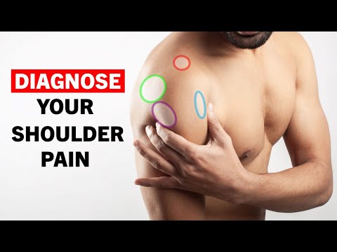 Self-Diagnose Your Shoulder Pain—With Simple Tests