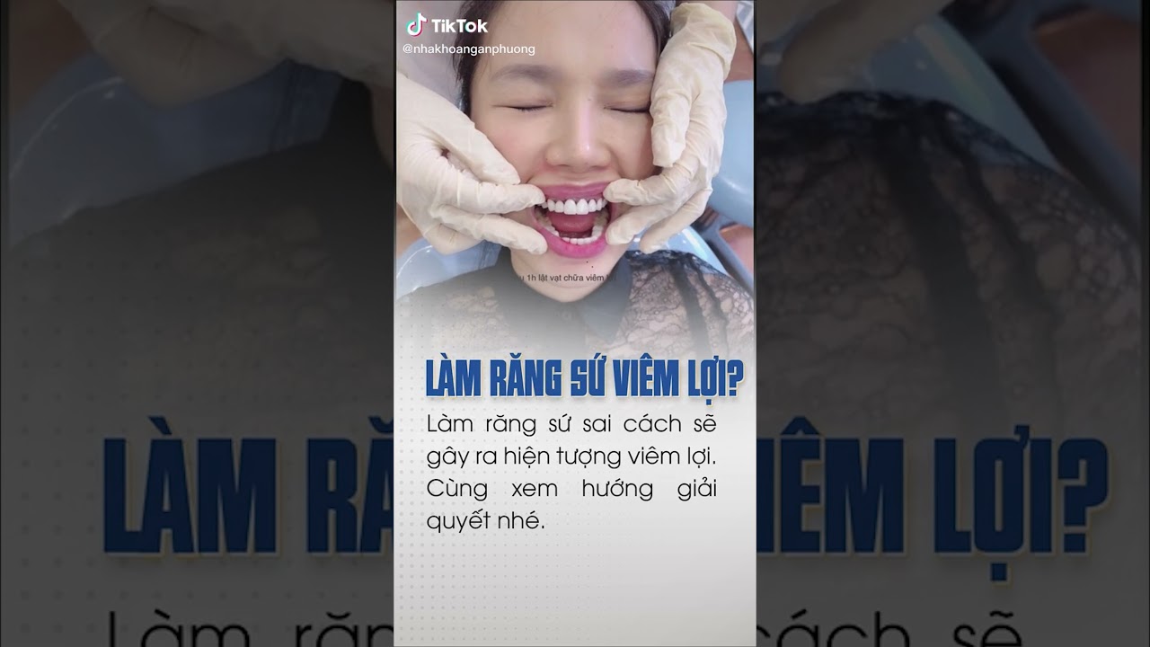 Bọc Răng Sứ Có Nguy Cơ Viêm Lợi? 🦷