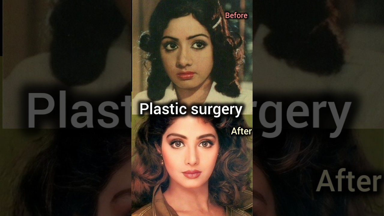 Shridevi's 29 Plastic Surgeries for Beauty ✨