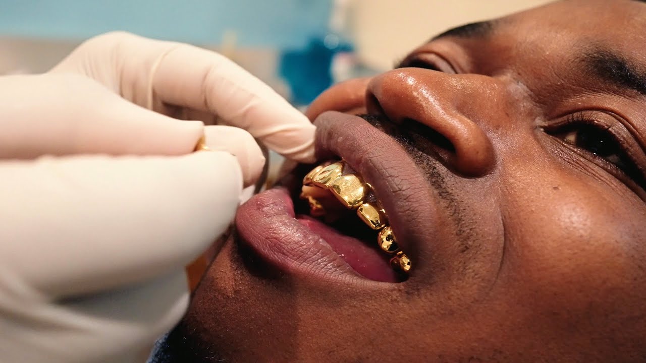 Wizz Havinn - Mode (Official Video) 🎶