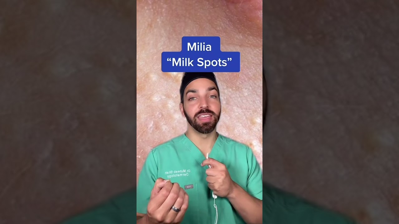 Milia Treatment Tips | DermDoctor #shorts