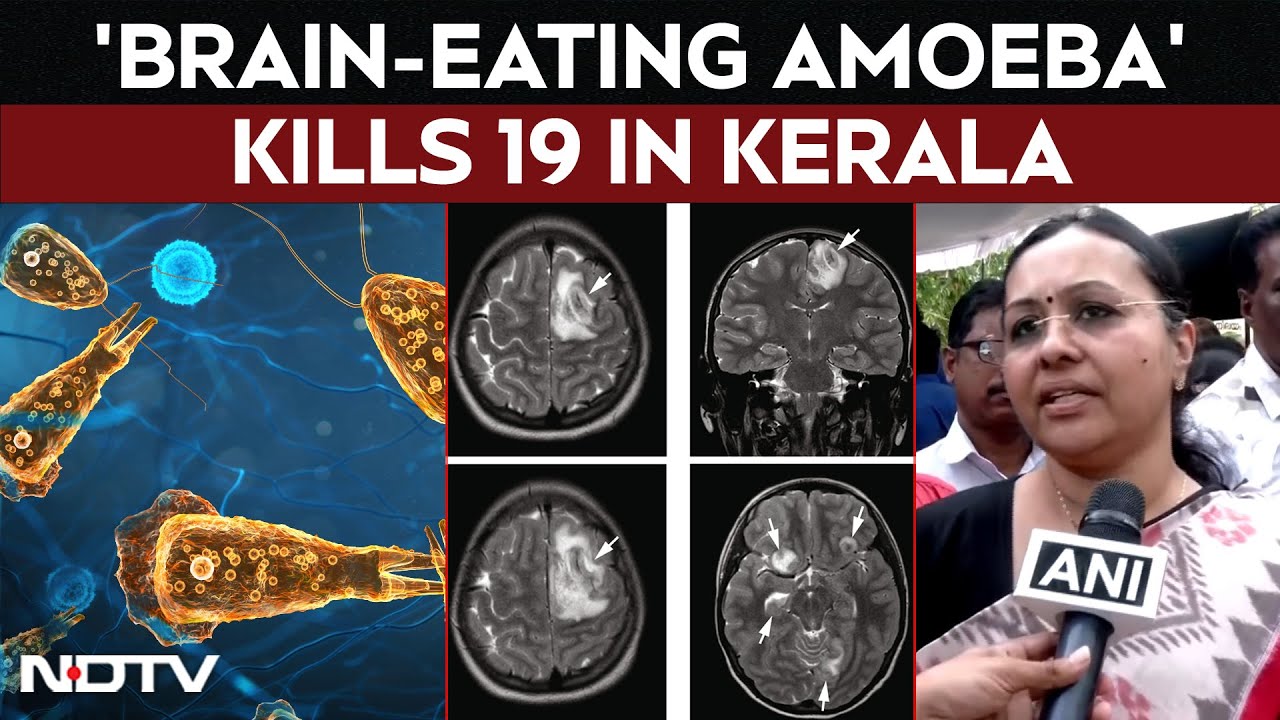 Kerala Amoeba Cases Rise to 19 🧠