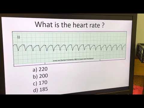 Telemetry Analysis: Video 1: Determining Regularity and Heart Rate