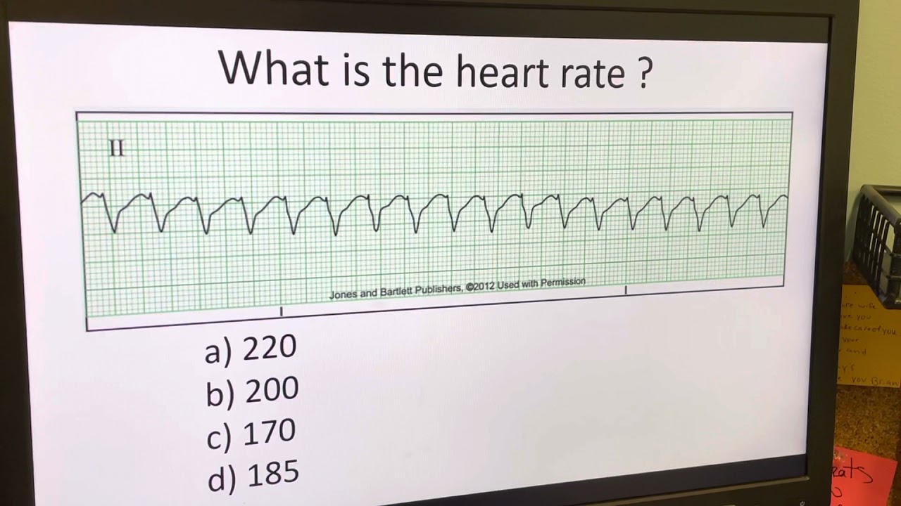 Unlocking Heart Rate Insights: Telemetry Analysis of Video 1 📊