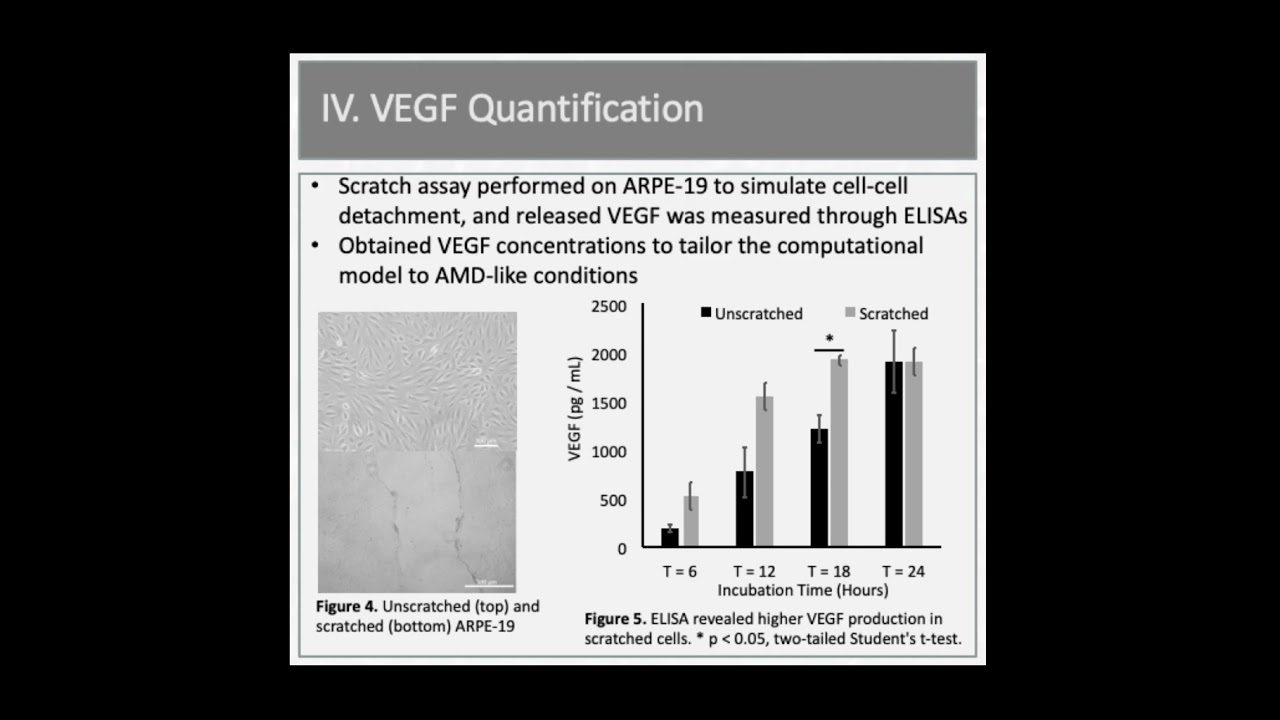 Innovative Computational Model for Wet AMD | Senior Design Project 2021 🧬