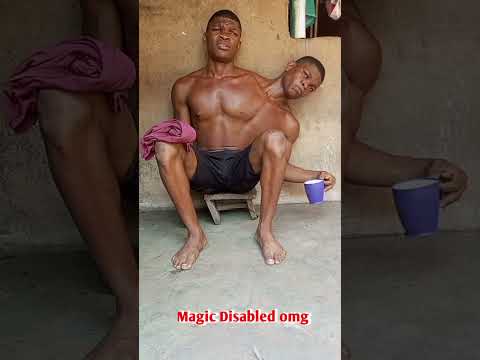 Tasbih song | Conjoined Twins brother#godblessyou#shorts#ytshorts#viralshort#newtiktokvideos