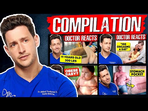 Doctor Mike Reacts To Rarest Diseases | Compilation