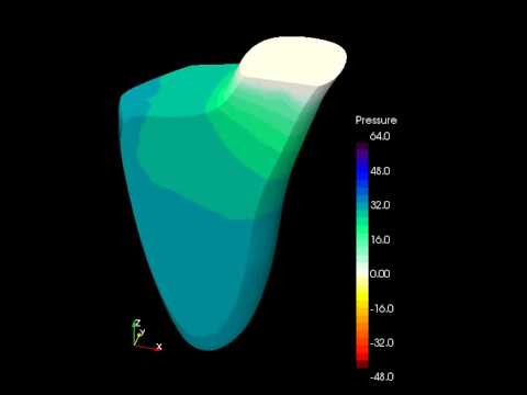 Simulation of pressure in human heart model