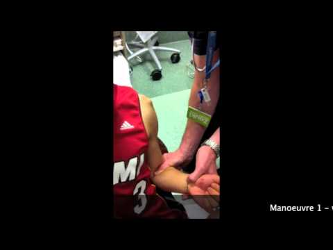 Kocher's Method for Shoulder Dislocation 🩺
