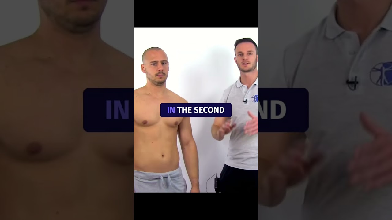 Speed's Test & Biceps Pathology ๐๏ธโโ๏ธ