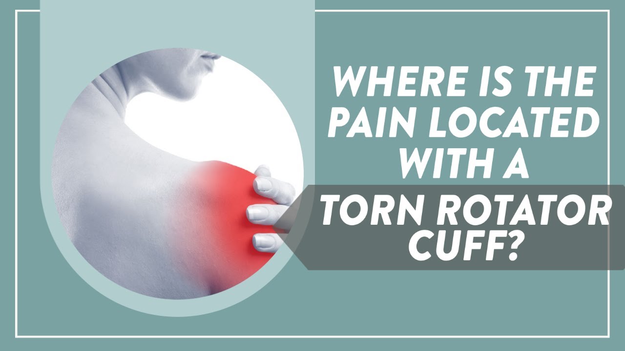 Rotator Cuff Tear Pain Locations 🤕
